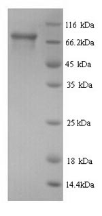 SDS-PAGE