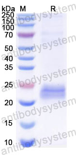 Валидация SDS-PAGE - AntibodySystem RRJ12901
