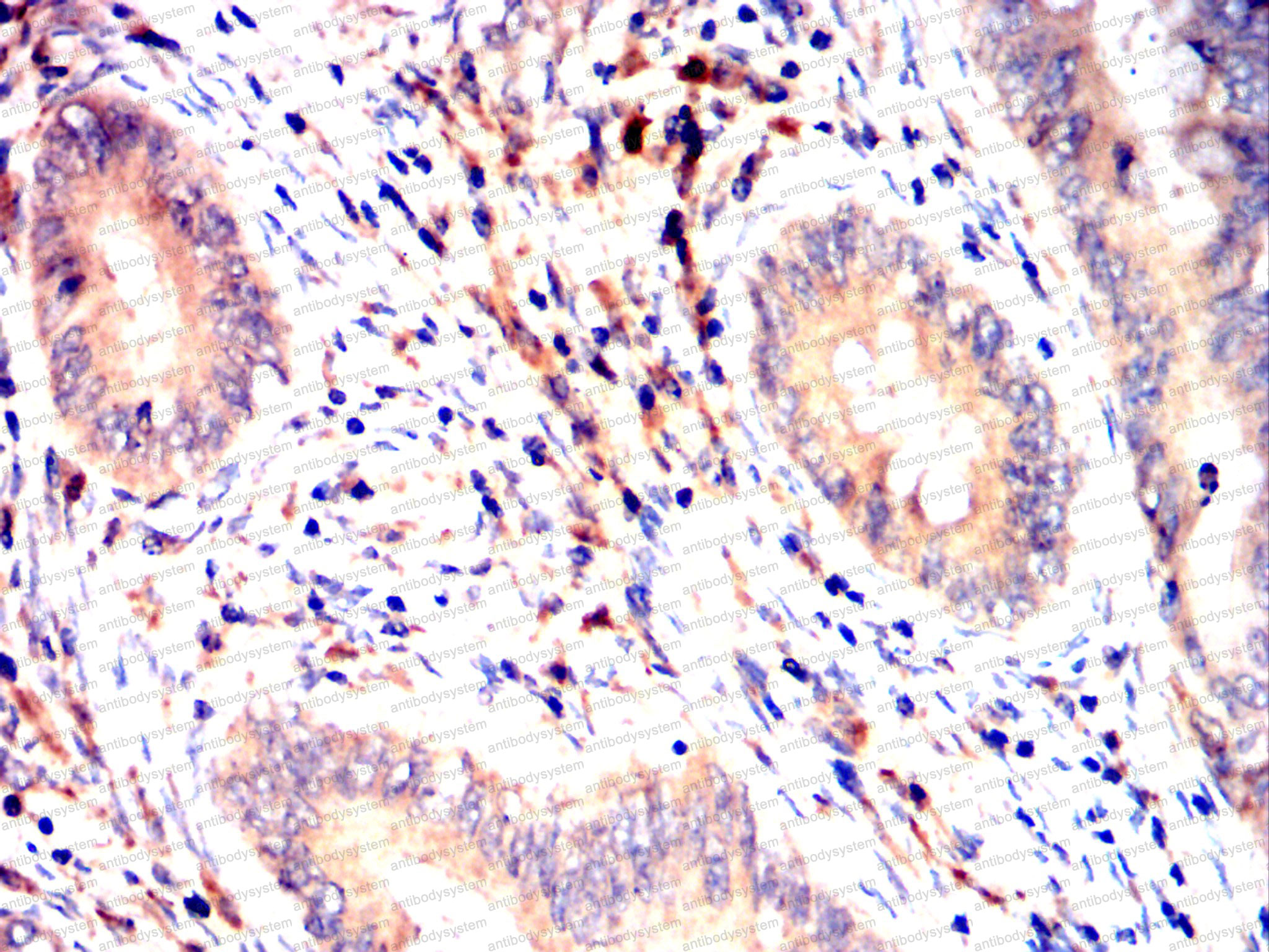 Валидация AntibodySystem RHD11501
