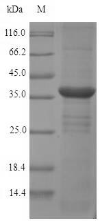 SDS-PAGE