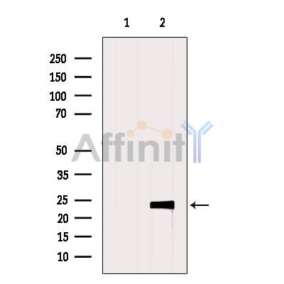 Валидация Affinity AF5216 - 2679