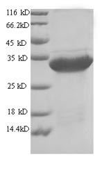 SDS-PAGE