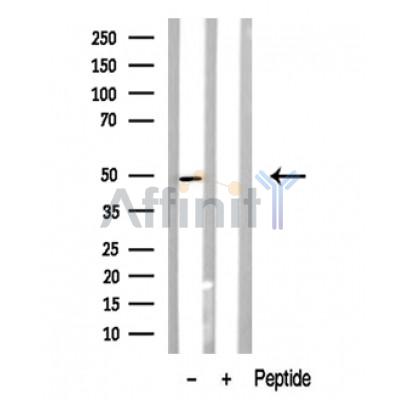 Валидация Affinity DF10317 - 5938