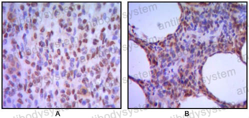 Валидация AntibodySystem RHH52401 (3303)