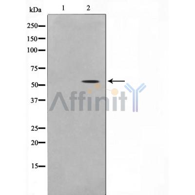 Валидация Affinity AF5301 - 2845