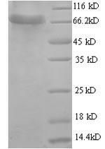 SDS-PAGE