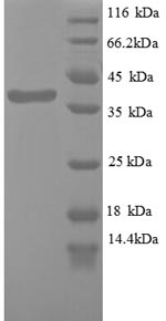 SDS-PAGE