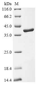SDS-PAGE