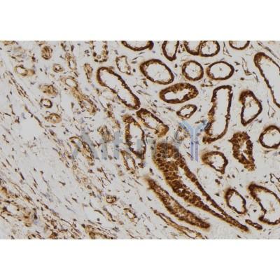 Валидация Affinity AF6264 - 3515