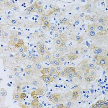 A10436, иммуногистохимия, парафиновые срезы печени человека (1695)