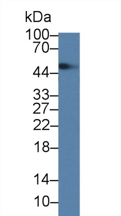 9561