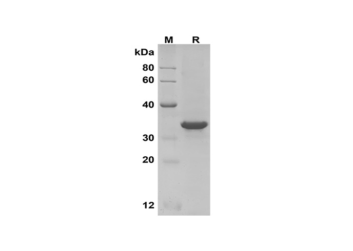 PDEH101134, электрофорез в ПААГ с ДСН