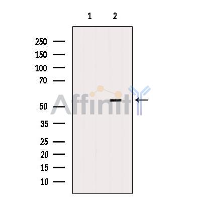 Валидация Affinity DF4915 - 16723