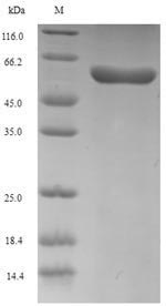 SDS-PAGE