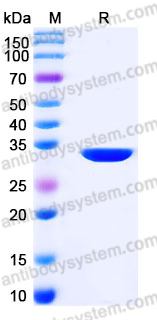 YHK02402, SDS-PAGE