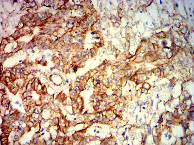 Валидация AntibodySystem RHE07609