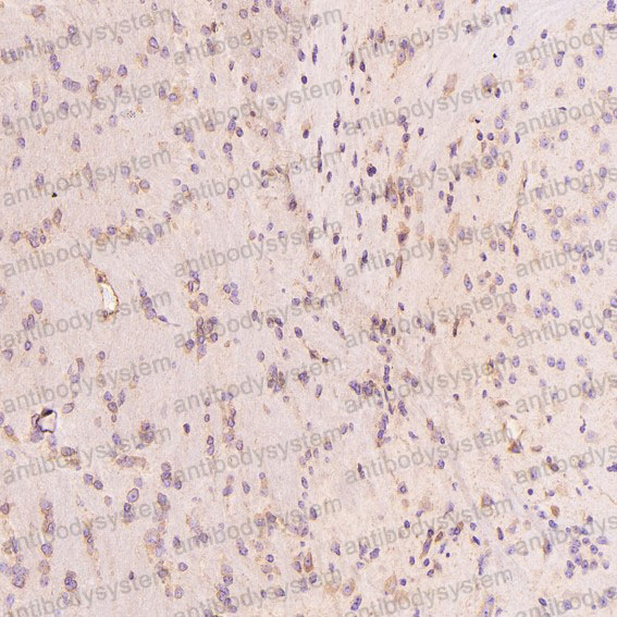 Валидация AntibodySystem RHD75201