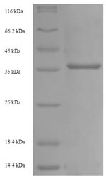 SDS-PAGE