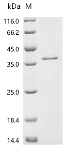 SDS-PAGE