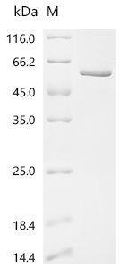 SDS-PAGE
