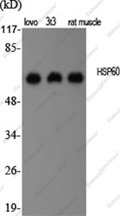 Вестерн-блоттинг, HSP60, различные клетки