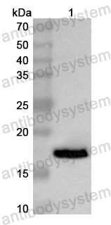 Валидация AntibodySystem PHB50201