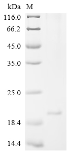 SDS-PAGE