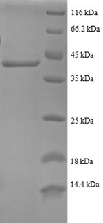 SDS-PAGE