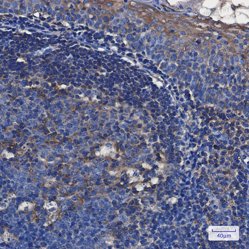 Валидация AntibodySystem RHK59701