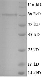 SDS-PAGE