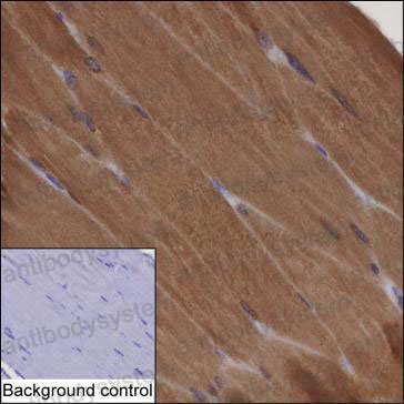 Валидация AntibodySystem RHK12003