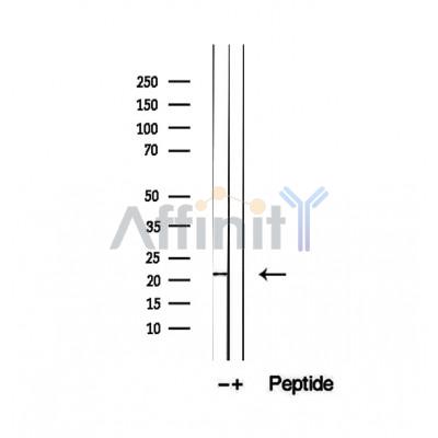 Валидация Affinity DF12458 - 6998