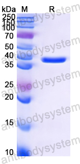 YZZ05101, SDS-PAGE