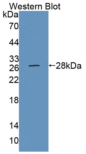 59014