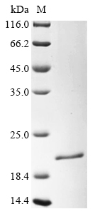 SDS-PAGE