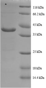 SDS-PAGE