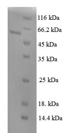 SDS-PAGE