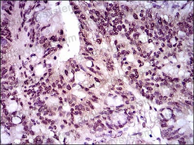 Валидация AntibodySystem RHA44202