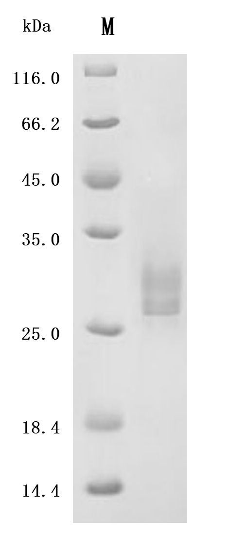 SDS-PAGE