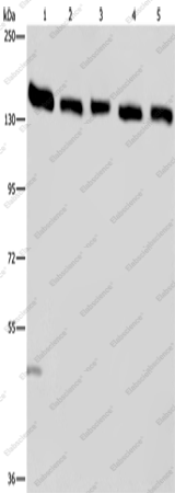 Вестерн-блоттинг, IPO4, клетки HeLa, A549, Jurkat, K562 и ткань яичка человека