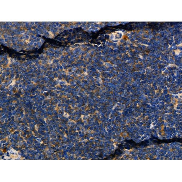 Валидация Affinity DF8539 - 20421