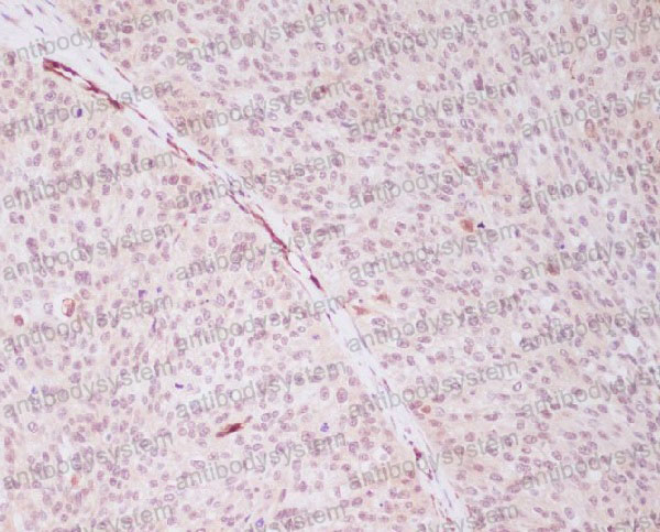 Валидация AntibodySystem RHN60501