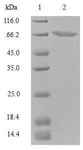 SDS-PAGE