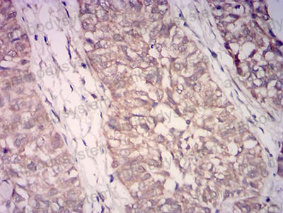 Валидация AntibodySystem RHN97301