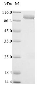 SDS-PAGE