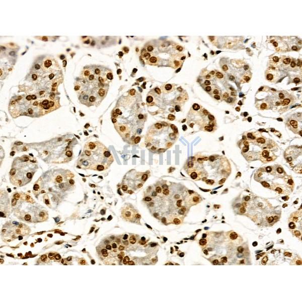 Валидация Affinity AF4356 - 2192