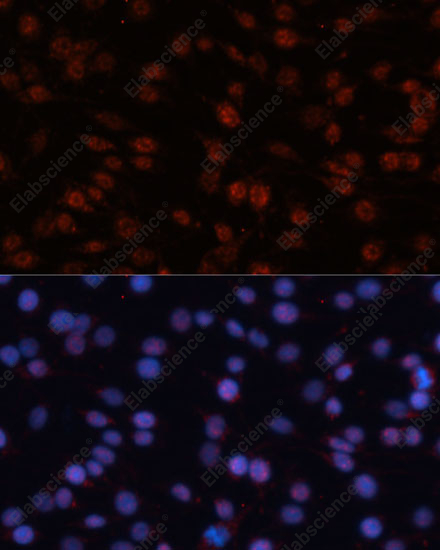 Иммунофлуоресценция, TCF4, клетки C6