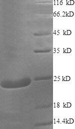 SDS-PAGE