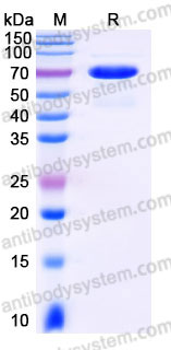EHC05101, SDS-PAGE