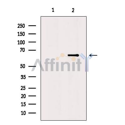 Валидация Affinity DF8579 - 20484